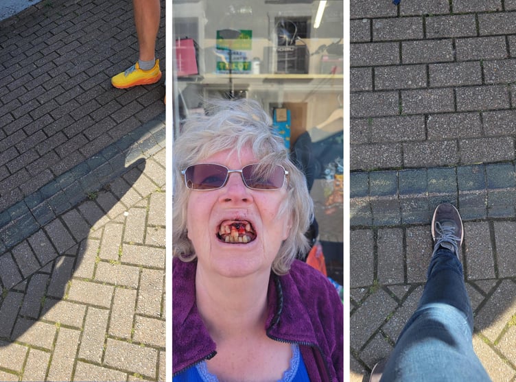 A Tenby woman suffered significant facial injuries after tripping and falling on the ‘unmarked’ kerb in Haverfordwest.