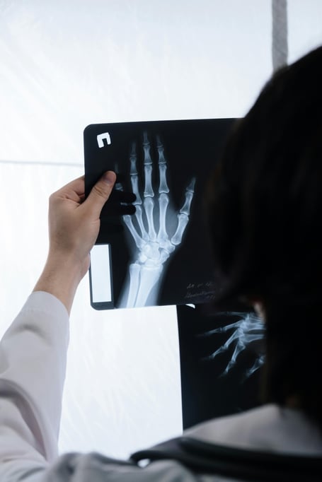 X-Ray