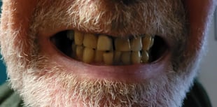 Teething pains: Superglue, pliers and years of tears