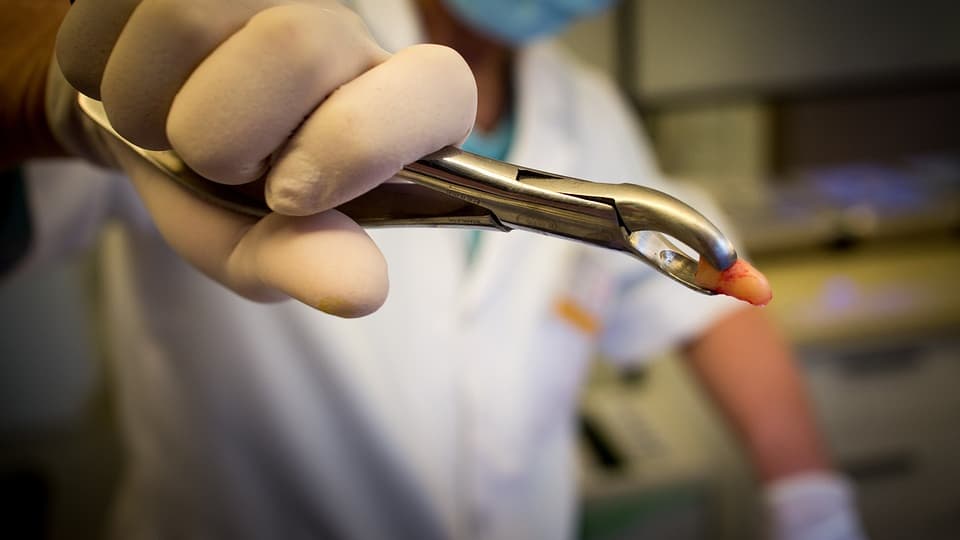 Wales' dental waitlist outpaces Wrexham's population!